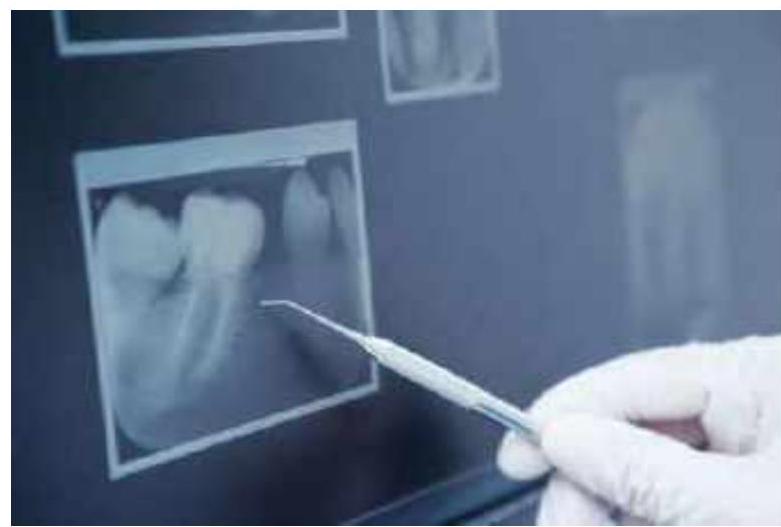 Digitale foto bij de tandarts
link